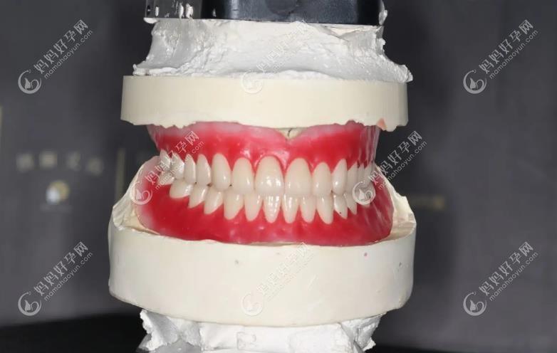 无牙颌制作过程排牙