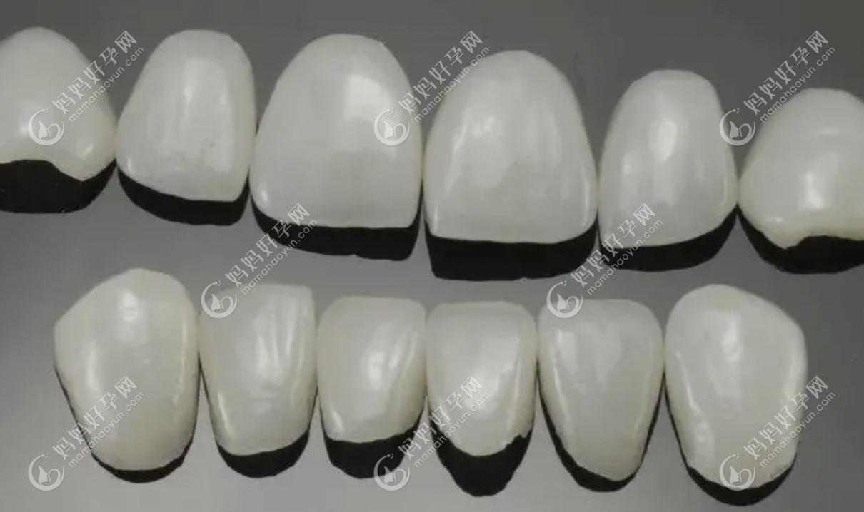 牙齿贴片用于牙齿美白修复