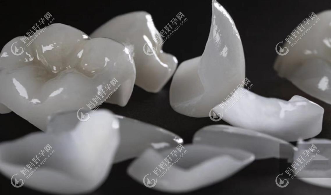 牙贴面的优点是快速美白/磨牙面积小,缺点是不能吃过硬食物