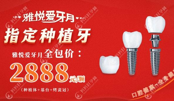 上海雅悦齿科种植牙一颗多钱?国产植体2888+;进口种植牙5500+