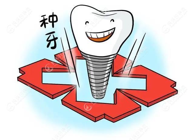 上海种植牙集采新进展:将对不参加种牙集采的口腔开展督察