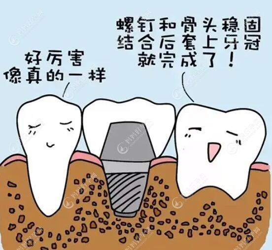 北京钛植口腔种植牙好吗,看看钛植口腔种植牙评价