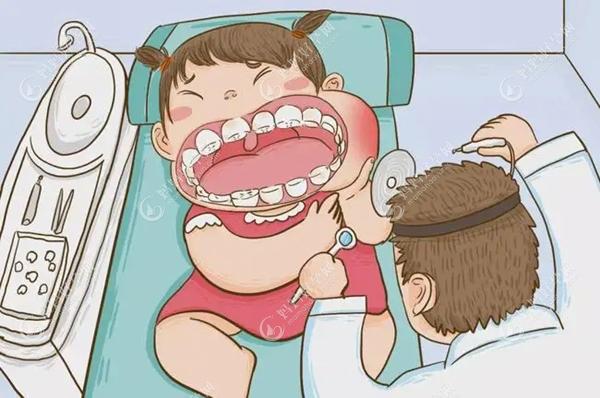 儿童补牙注意事项