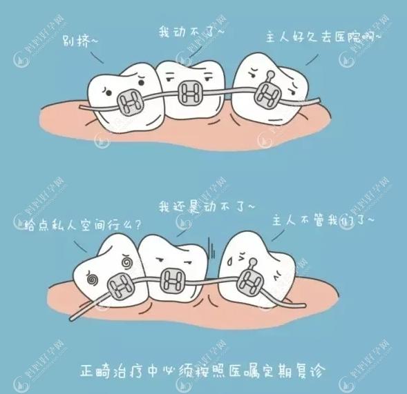 牙齿矫正www.mamahaoyun.com