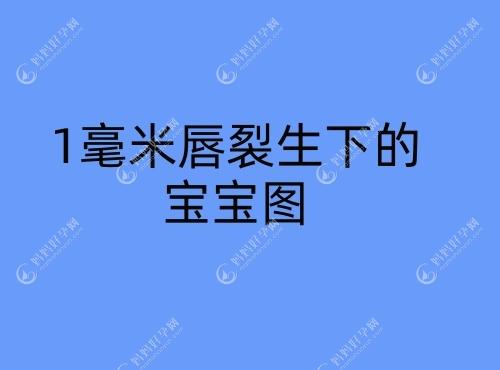 1毫米唇裂生下的宝宝图