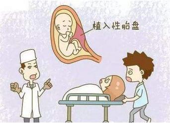 胎盘植入是什么意思