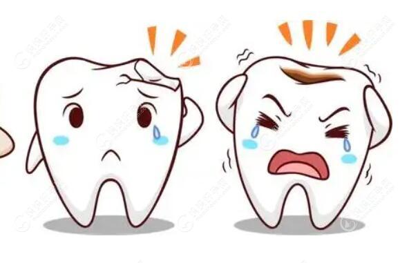 嵌体补牙和树脂补牙的区别在于:价格,适应症,材料强度不同