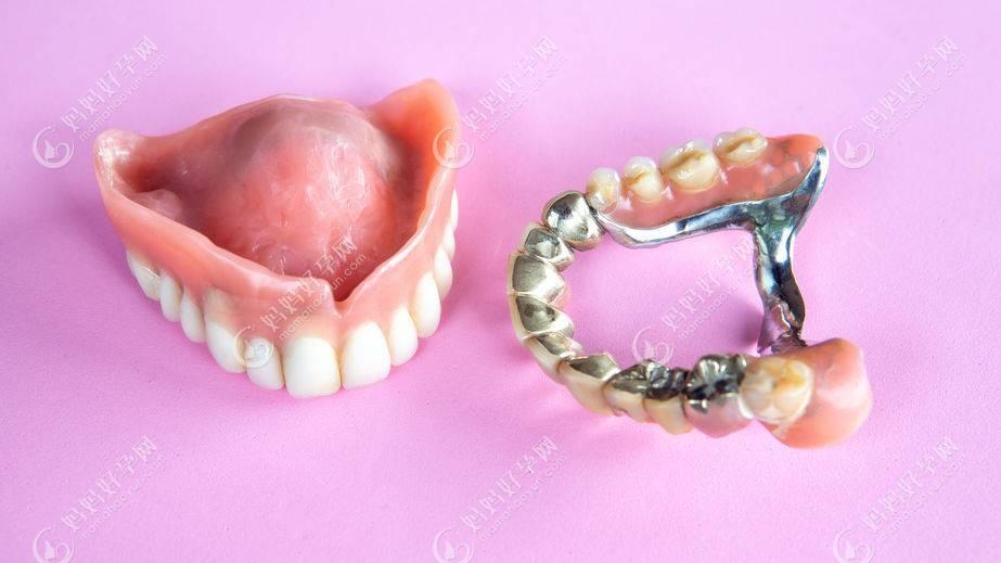 半口活动假牙结构示意图