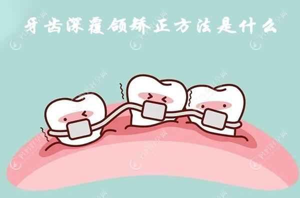 牙齿深覆合矫正方法是什么?选择降低前牙好还是升高后牙好