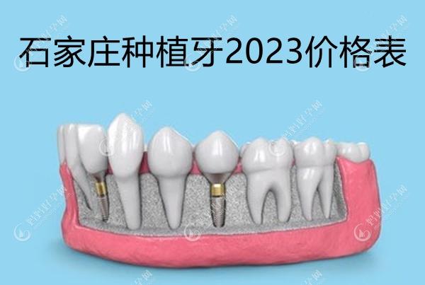 石家庄种植牙2023价格表:(免费咨询正规医院种牙4300元起一颗)