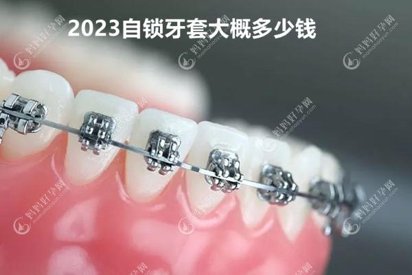 2023自锁牙套价目表mamahaoyun.com