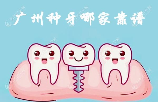 广州种牙哪家靠谱?看天河区/荔湾区做种植牙便宜又好的牙科