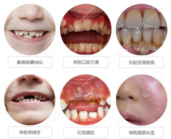 儿童牙齿畸形的危害mamahaoyun.com/