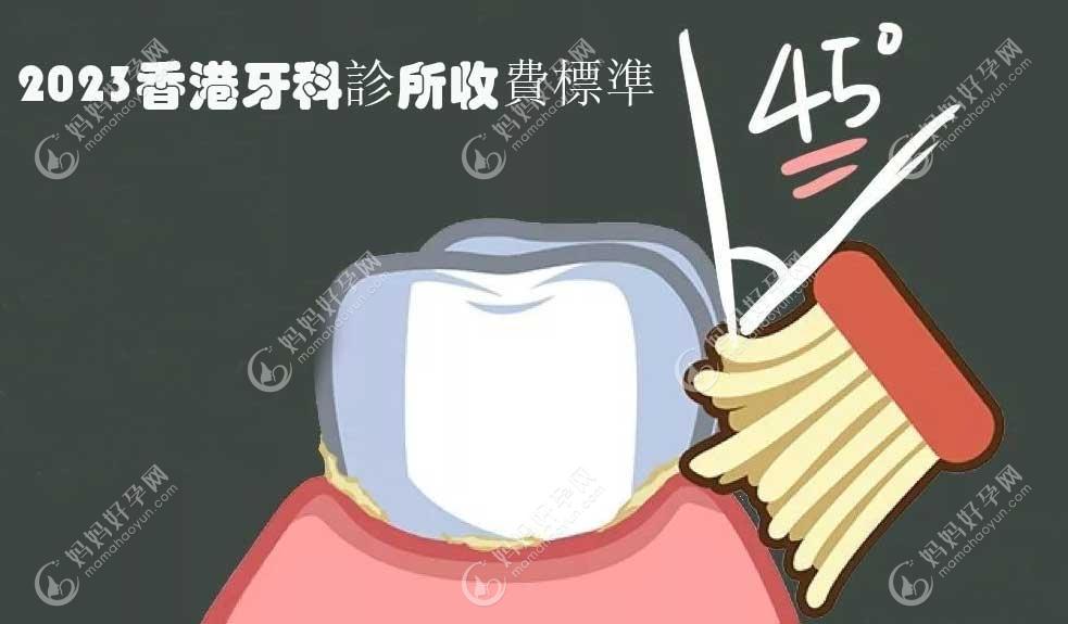 2023香港牙科診所收費標準:種植牙價格22000/根管治療費用3500