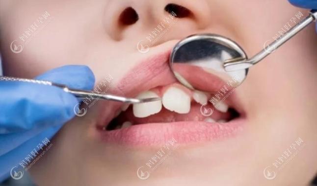 千万别给孩子矫正牙齿，去黑心诊所做牙齿矫正是个坑！www.mamahaoyun.com