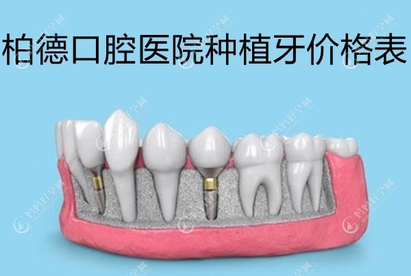 柏德口腔医院种植牙价格表:柏德一颗进口牙3980+,即刻全口牙.