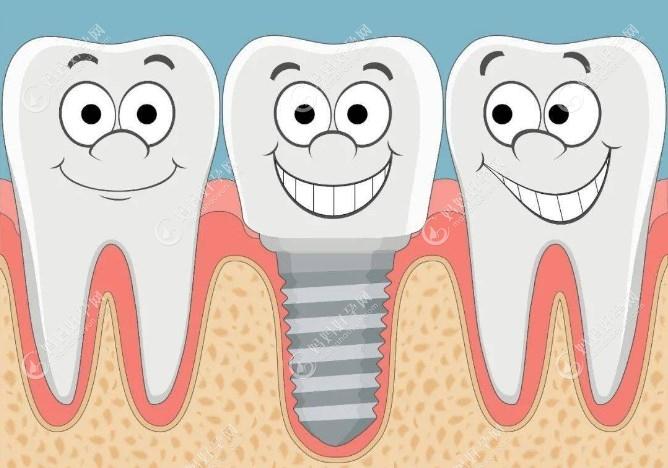 广州中家医口腔2023年看牙真优惠,免费种牙是真的吗