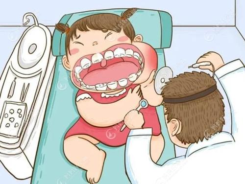 后悔给孩子做根管治疗的说说,因为做根管治疗会影响换牙吗