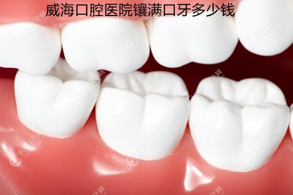 威海口腔医院镶满口牙多少钱,含全口种植牙/活动假牙的价格