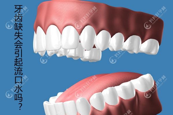 牙齿缺失会引起流口水吗?缺牙导致流口水解决方法有这几种