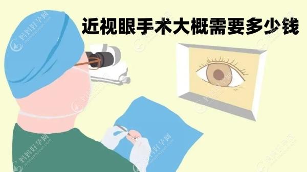 近视眼手术大概需要多少钱?2023近视手术价格是9000-3万元起