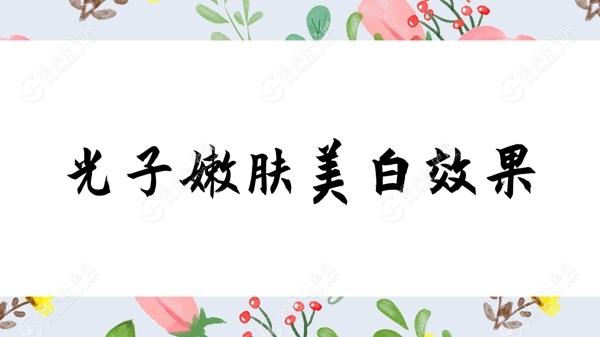 光子嫩肤美白疗效