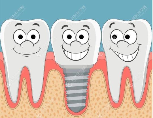 牙齿种植的危害有什么呢