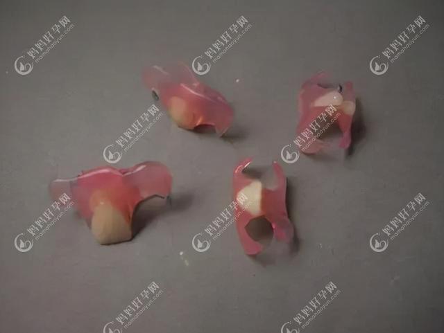 即刻种植牙后可以装单颗义齿单颗义齿www.mamahaoyun.com