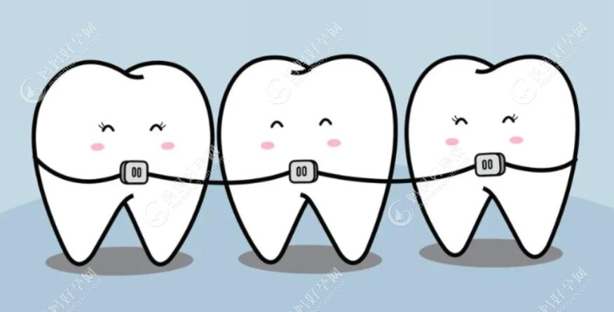 南京青少年牙齿正畸做得好的医院有哪些