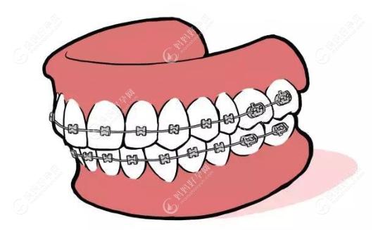 广州牙齿矫正去哪家医院比较好？答案在这份排名前十榜里