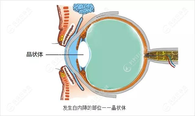 广州爱尔眼科医院做白内障手术较好的医生