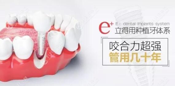 北京中诺第二口腔医院做种植牙医生名单