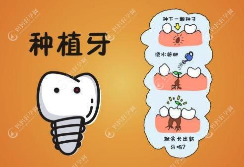 北京微创种植牙到底选哪家医院比较好