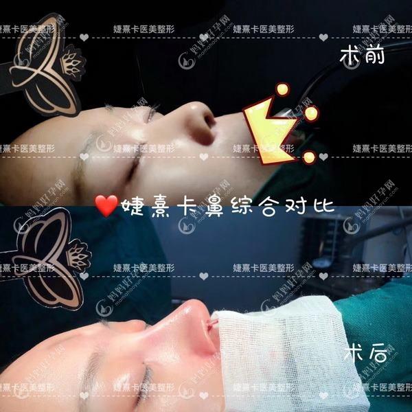 巫溪县悦己婕熹卡医疗美容诊所