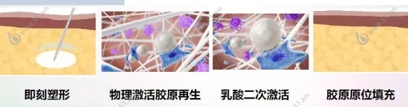 濡白天使针适合填充哪个位置