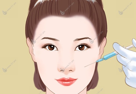 悦龄塑填充能维持多久?1-3年左右,不是生长因子和骨粉可溶解