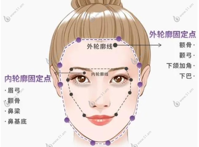 婕瑞玻尿酸适合填充哪里？