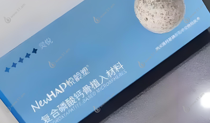 悦龄塑有优点没移位缺点